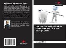 Bookcover of Endodontic treatment on teeth with incomplete rhizogenesis