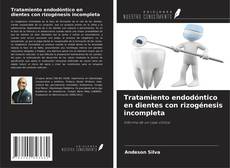 Buchcover von Tratamiento endodóntico en dientes con rizogénesis incompleta