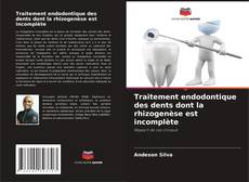 Buchcover von Traitement endodontique des dents dont la rhizogenèse est incomplète