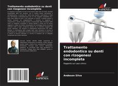 Обложка Trattamento endodontico su denti con rizogenesi incompleta