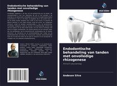 Capa do livro de Endodontische behandeling van tanden met onvolledige rhizogenese 