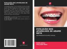 Buchcover von EVOLUÇÃO DOS APARELHOS DE ARAME RETO