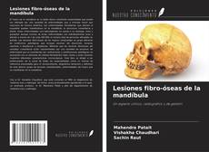 Buchcover von Lesiones fibro-óseas de la mandíbula