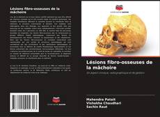 Buchcover von Lésions fibro-osseuses de la mâchoire