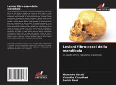Buchcover von Lesioni fibro-ossei della mandibola