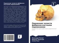 Buchcover von Поражения челюсти фиброзно-костными поражениями