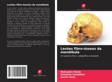 Buchcover von Lesões fibro-ósseas da mandíbula