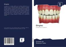 Bookcover of Gingiva:
