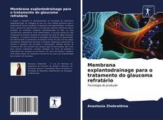 Copertina di Membrana explantodrainage para o tratamento do glaucoma refratário