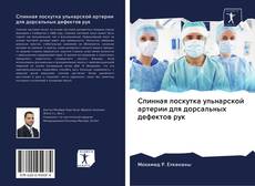 Buchcover von Спинная лоскутка ульнарской артерии для дорсальных дефектов рук