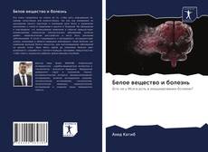 Bookcover of Белое вещество и болезнь