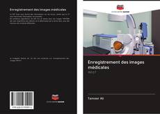 Enregistrement des images médicales kitap kapağı