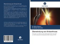 Bookcover of Überwindung von Kniearthrose