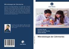 Buchcover von Mikrobiologie der Zahnkaries
