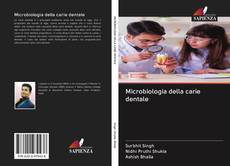 Copertina di Microbiologia della carie dentale