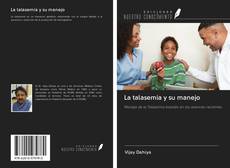 Bookcover of La talasemia y su manejo