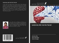 Buchcover von Lesiones del nervio facial