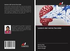 Buchcover von Lesioni del nervo facciale