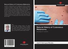 Bookcover of Natural History of Cutaneous Melanoma.
