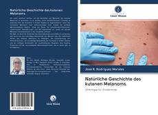Buchcover von Natürliche Geschichte des kutanen Melanoms.