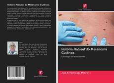 Buchcover von História Natural do Melanoma Cutâneo.