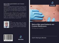 Bookcover of Natuurlijke geschiedenis van Cutane Melanoom.