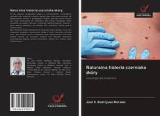 Naturalna historia czerniaka skóry kitap kapağı