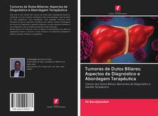 Tumores de Dutos Biliares: Aspectos de Diagnóstico e Abordagem Terapêutica的封面