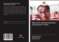 BRACKETS ORTHODONTIQUES : ÉVOLUTION ET TYPES kitap kapağı