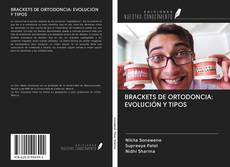 BRACKETS DE ORTODONCIA: EVOLUCIÓN Y TIPOS kitap kapağı