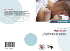 Copertina di Post-partum