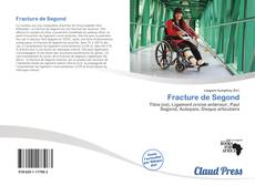 Bookcover of Fracture de Segond