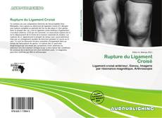 Bookcover of Rupture du Ligament Croisé