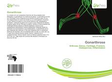 Buchcover von Gonarthrose