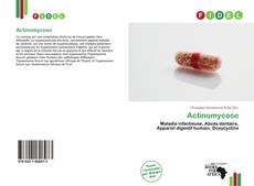 Bookcover of Actinomycose