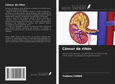 Copertina di Cáncer de riñón
