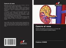Buchcover von Cancro al rene