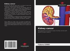 Kidney cancer的封面