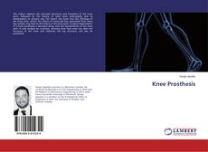 Knee Prosthesis kitap kapağı