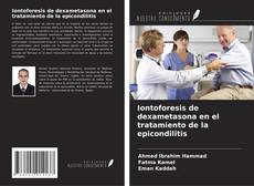 Buchcover von Iontoforesis de dexametasona en el tratamiento de la epicondilitis