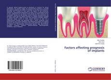Bookcover of Factors affecting prognosis of implants