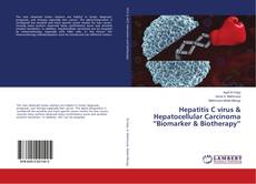 Portada del libro de Hepatitis C virus & Hepatocellular Carcinoma “Biomarker & Biotherapy”