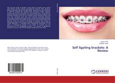 Copertina di Self ligating brackets: A Review