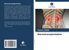 Buchcover von Nierentransplantation