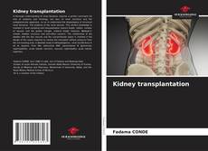 Kidney transplantation的封面