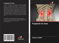Buchcover von Trapianti di rene