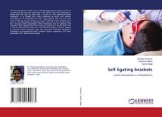 Buchcover von Self ligating brackets