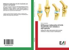 Copertina di Differenze rieducative di LCA ricostruito con rotuleo o std+gracile