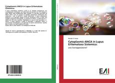 Bookcover of Cytoplasmic-ANCA in Lupus Eritematoso Sistemico: