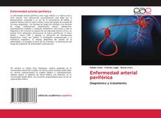 Bookcover of Enfermedad arterial periférica